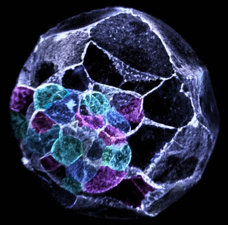 Stem cells sound magical, but they’re not all created equal. Here’s what you need to know 1 blastocyst embryo