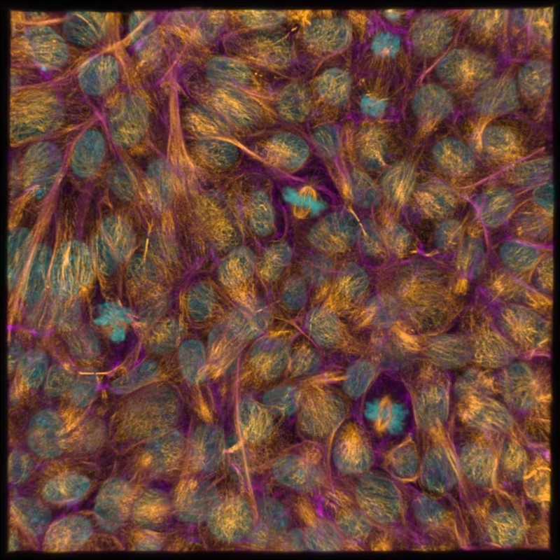 Stem cells sound magical, but they’re not all created equal. Here’s what you need to know 2 induced pluripotent stem cells